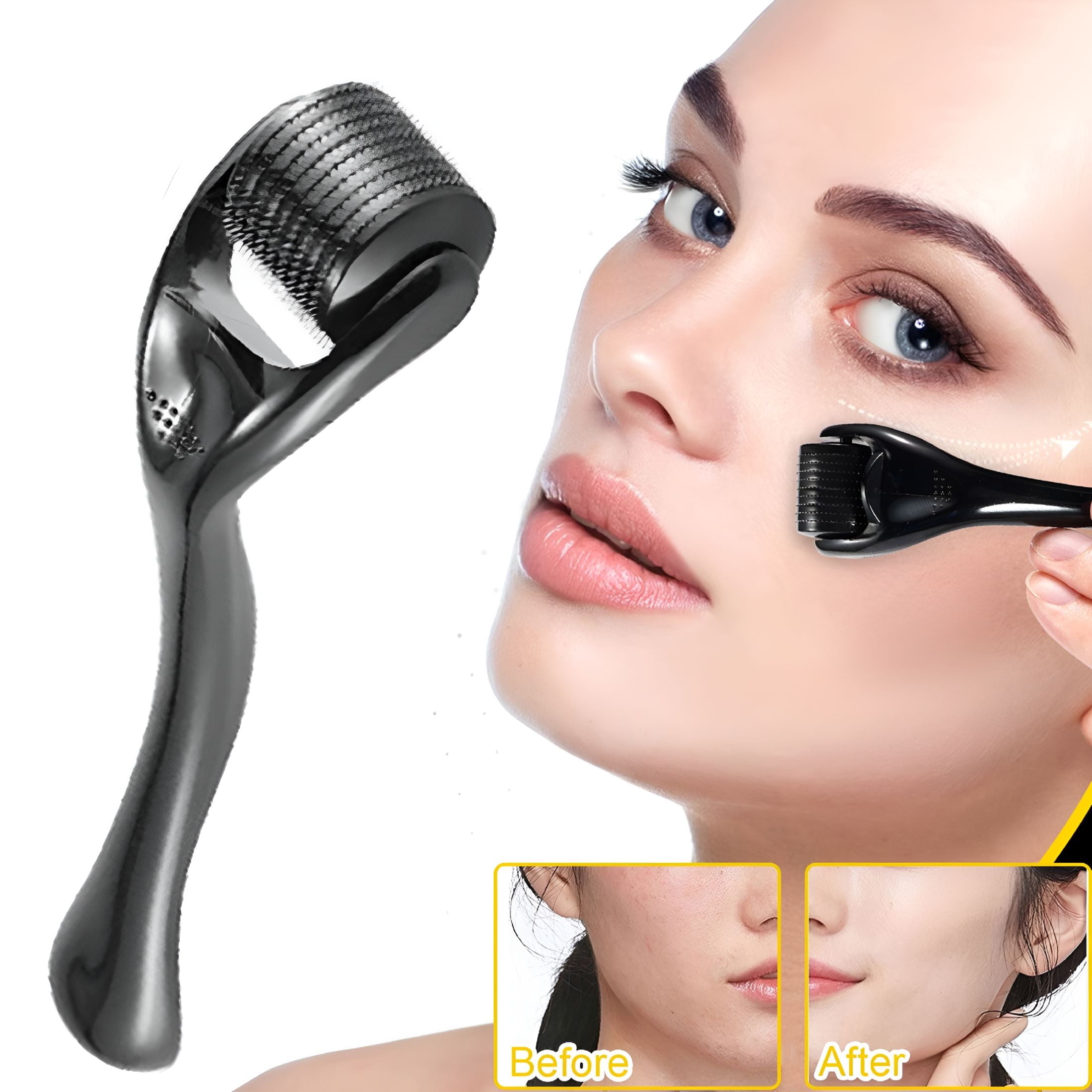 2026 New Derma Roller for Face Hair Beard Scalp 0.3Mm Microneedle Roller with Safe Storage Case Personal Beauty Instr... - Image 4