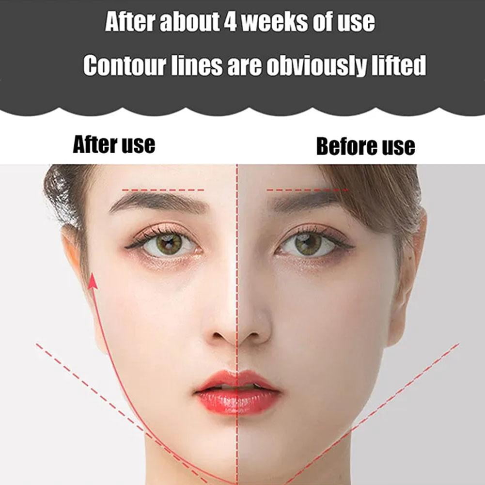 EMS Face Lifting Roller RF Double Chin V Face Shaped Massager Facial LiftUp Y4 - Image 6