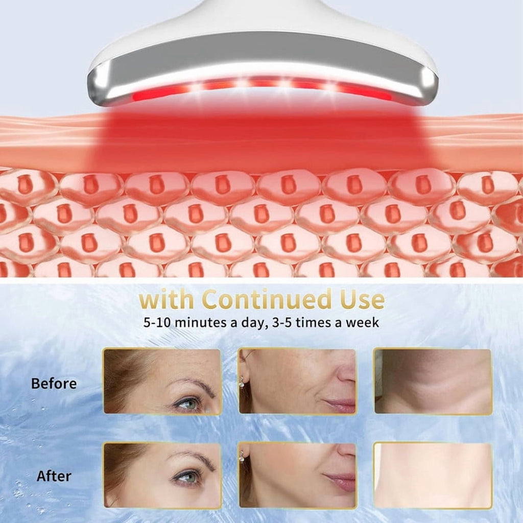 Facial Neck Beauty Device, Skin Care Massager, LED Light Therapy Face Sculpting Tool, Multifunctional Rollers for Women - Image 2