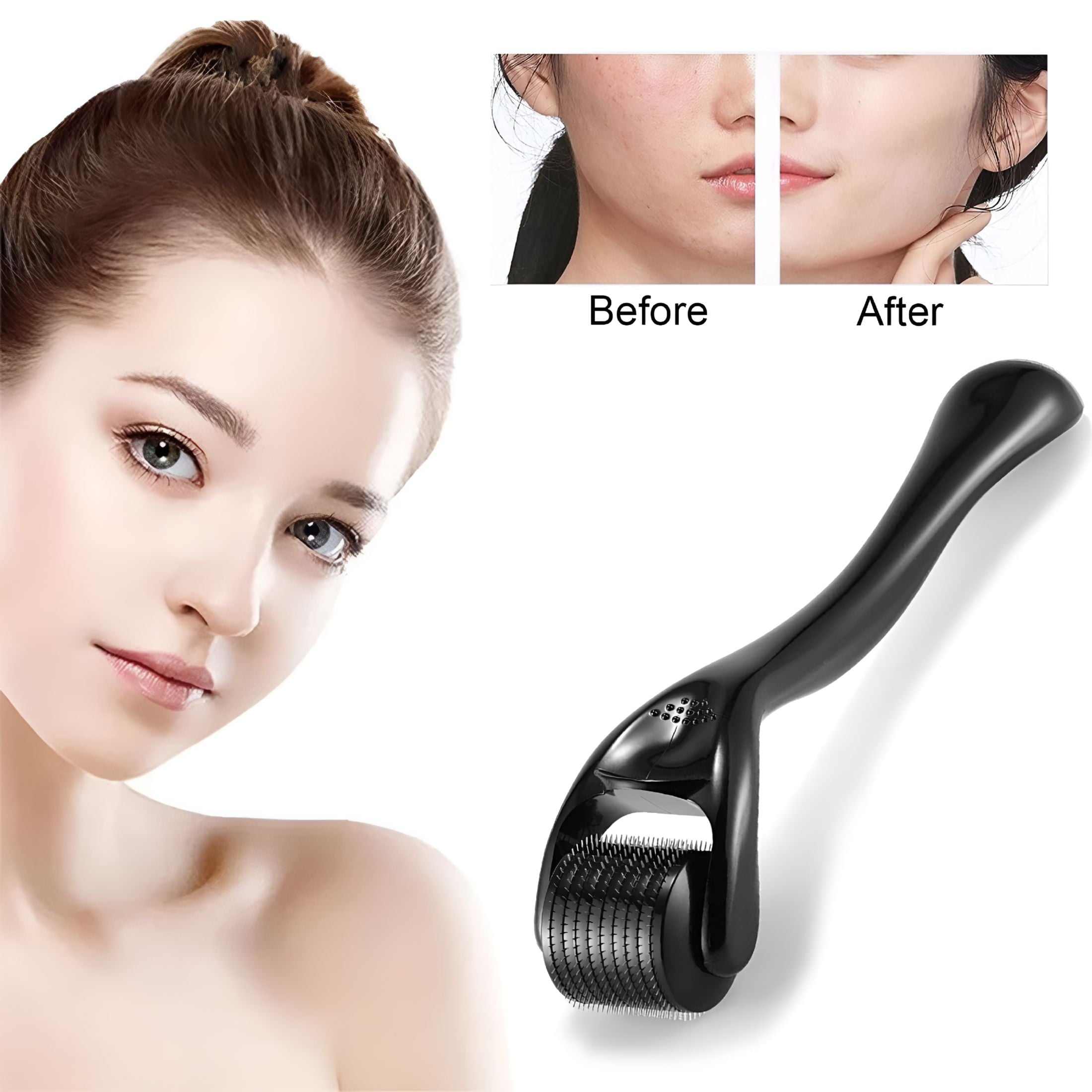 2026 New Derma Roller for Face Hair Beard Scalp 0.3Mm Microneedle Roller with Safe Storage Case Personal Beauty Instr... - Image 3