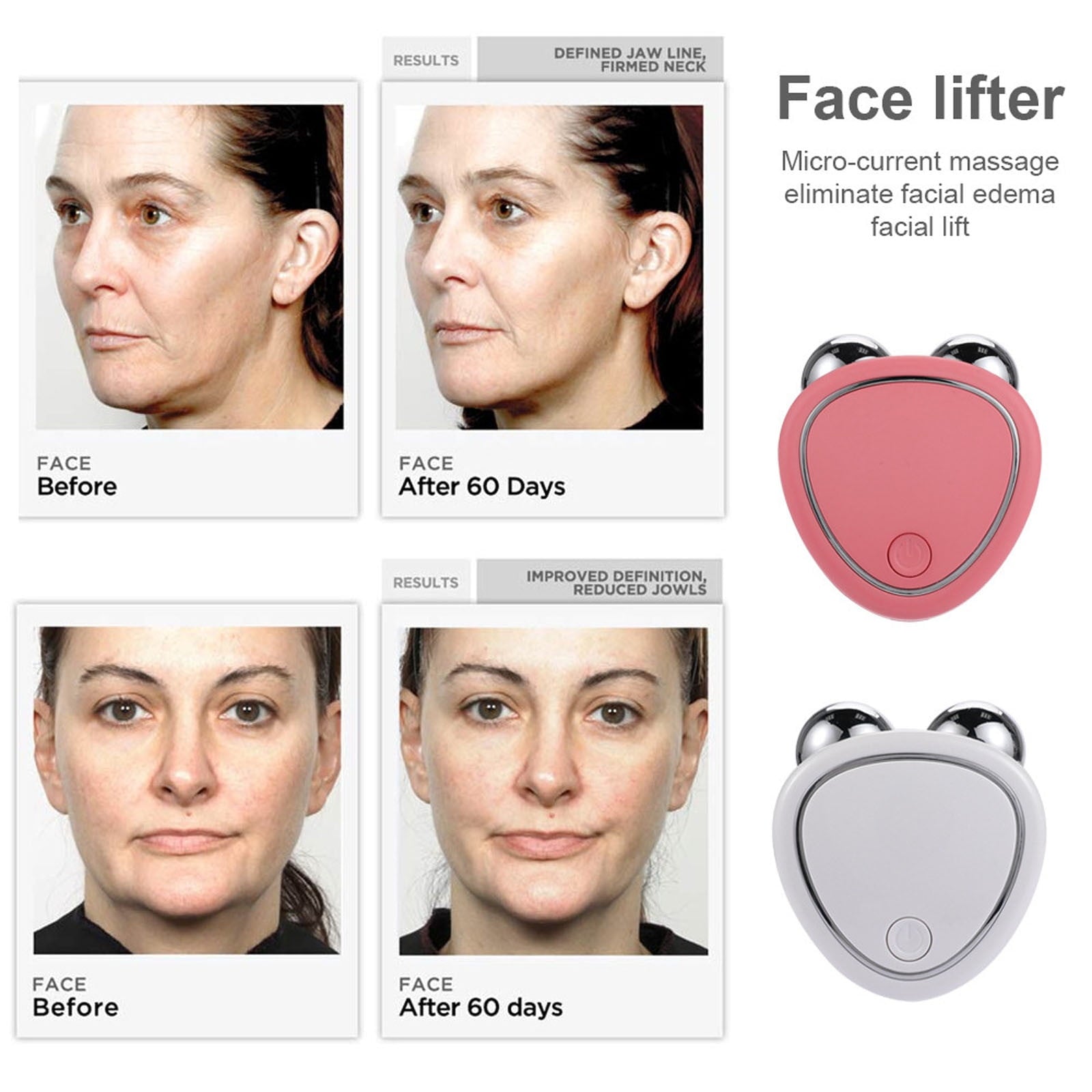Clearance Microcurrent Face Lift Device, Microcurrent Face Device Roller USB Microcurrent Facial Device for Anti-Agin... - Image 6